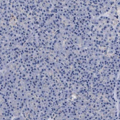 Immunohistochemistry-Paraffin: ACOX1 Antibody [NBP1-80950]