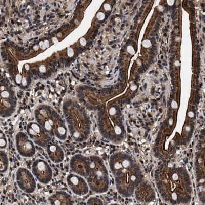 Immunohistochemistry-Paraffin: ACOX1 Antibody [NBP1-80951]