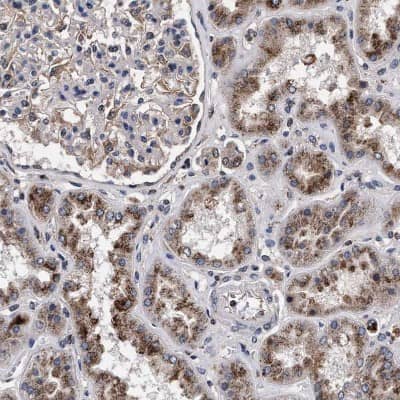 Immunohistochemistry-Paraffin: ACOX1 Antibody [NBP1-80951]