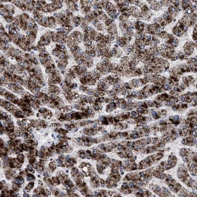 Immunohistochemistry-Paraffin: ACOX1 Antibody [NBP1-80951]