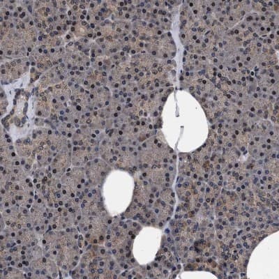 Immunohistochemistry-Paraffin: ACOX1 Antibody [NBP1-80951]