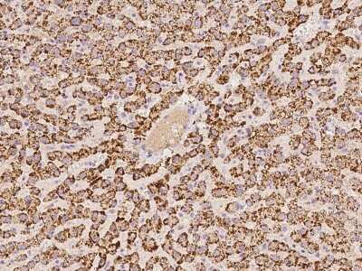 Immunohistochemistry-Paraffin: ACOX1 Antibody [NBP2-97895]