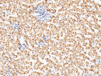 Immunohistochemistry-Paraffin: ACOX1 Antibody [NBP2-99761]