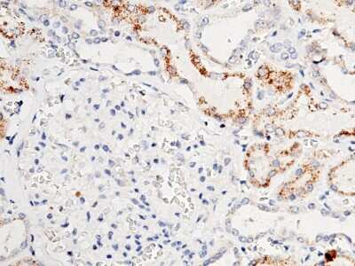 Immunohistochemistry-Paraffin: ACOX1 Antibody [NBP2-99761]