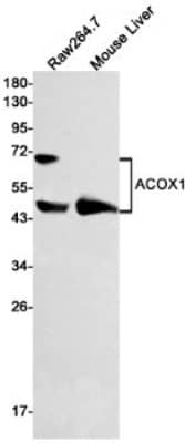 Western Blot: ACOX1 Antibody (S08-2E5) [NBP3-19556]