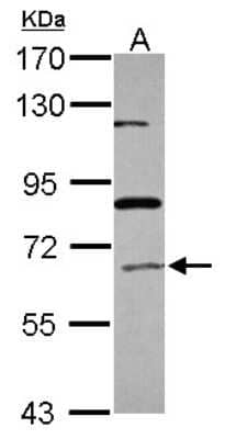 Western Blot: ACOX1 Antibody [NBP2-15249]