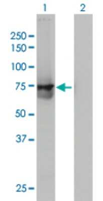 Western Blot: ACOX2 Antibody (1D1) [H00008309-M01]