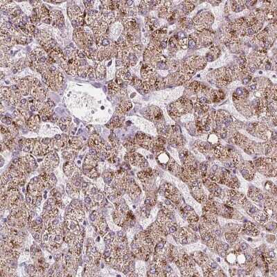 Immunohistochemistry-Paraffin: ACOX2 Antibody [NBP2-57292]