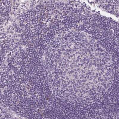 Immunohistochemistry-Paraffin: ACOX2 Antibody [NBP2-57292]