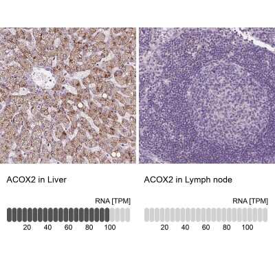 Immunohistochemistry-Paraffin: ACOX2 Antibody [NBP2-57292]