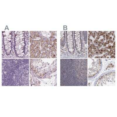 Immunohistochemistry-Paraffin: ACOX2 Antibody [NBP2-57292]