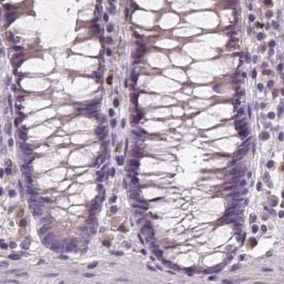 Immunohistochemistry-Paraffin: ACOX2 Antibody [NBP2-57292]
