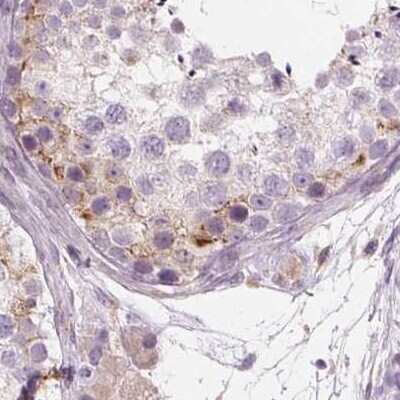 Immunohistochemistry-Paraffin: ACOX2 Antibody [NBP2-57292]