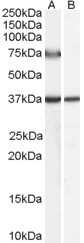 Western Blot: ACOX2 Antibody [NB100-57853]