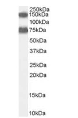 Western Blot: ACOX2 Antibody [NBP1-06011]