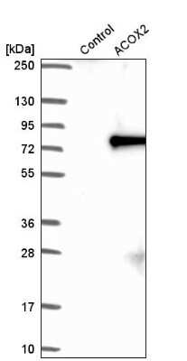 Western Blot: ACOX2 Antibody [NBP2-57292]