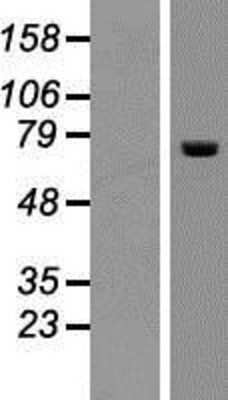 Western Blot: ACOX2 Overexpression Lysate [NBP2-08001]