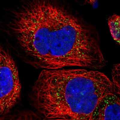Immunocytochemistry/ Immunofluorescence: ACOX3 Antibody [NBP1-85901]