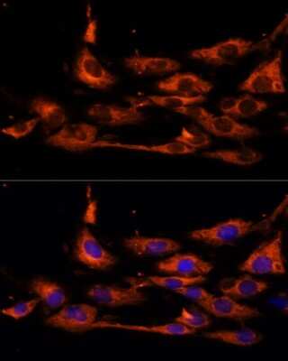 Immunocytochemistry/ Immunofluorescence: ACOX3 Antibody - Azide and BSA Free [NBP3-15513]