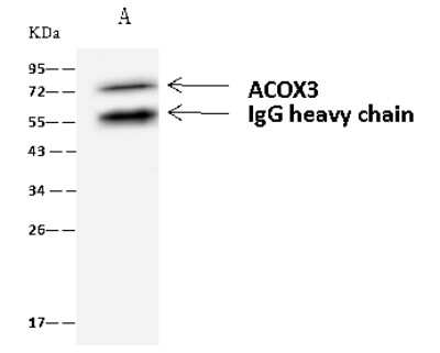 Immunoprecipitation: ACOX3 Antibody [NBP2-98600]