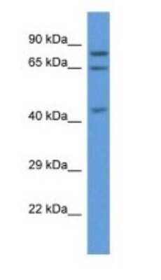 Western Blot: ACOX3 Antibody [NBP1-74273]