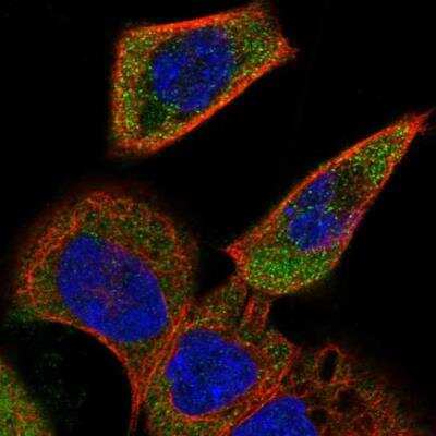 Immunocytochemistry/ Immunofluorescence: ACOXL Antibody [NBP2-34002]