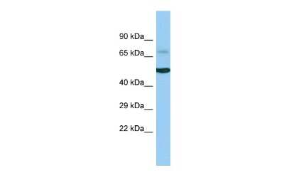 Western Blot: ACOXL Antibody [NBP2-84385]