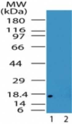 Western Blot: LMW-PTP/ACP1 AntibodyIsoform B [NB100-56477]