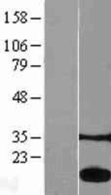 Western Blot: LMW-PTP/ACP1 Overexpression Lysate [NBL1-07250]