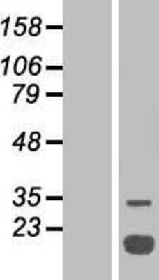 Western Blot: LMW-PTP/ACP1 Overexpression Lysate [NBP2-07886]