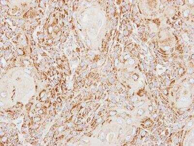 Immunohistochemistry-Paraffin: ACP2 Antibody [NBP2-15250]