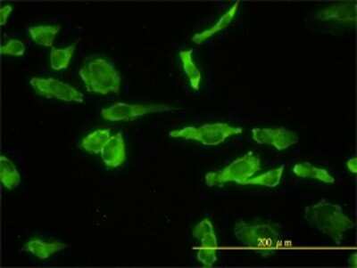 Immunocytochemistry/ Immunofluorescence: ACP2 Antibody (M1-4A12) [H00000053-M01]