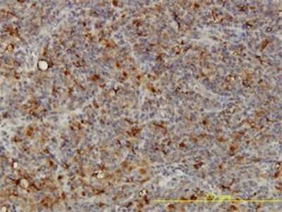 Immunohistochemistry-Paraffin: ACP2 Antibody (M1-4A12) [H00000053-M01]