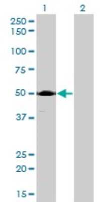 Western Blot: ACP2 Antibody (M1-4A12) [H00000053-M01]