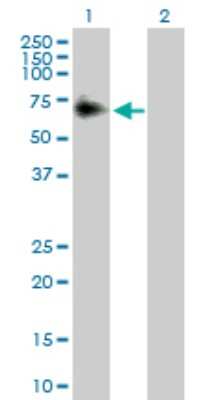 Western Blot: ACP2 Antibody [H00000053-D01P]