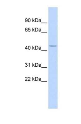 Western Blot: ACP2 Antibody [NBP1-62491]