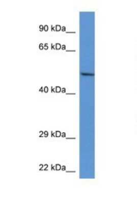 Western Blot: ACP2 Antibody [NBP1-74241]