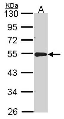 Western Blot: ACP2 Antibody [NBP2-15250]