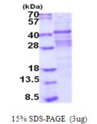 SDS-PAGE: Recombinant Human ACP2 His Protein [NBP2-51966]