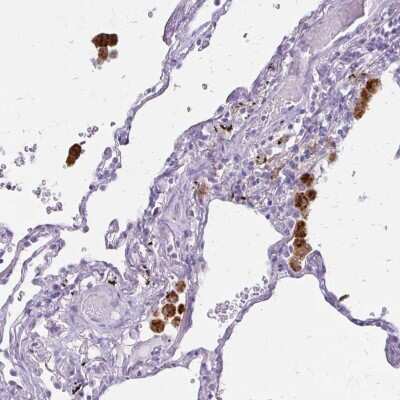 Immunohistochemistry-Paraffin: TRACP/PAP/ACP5 Antibody [NBP2-38874]