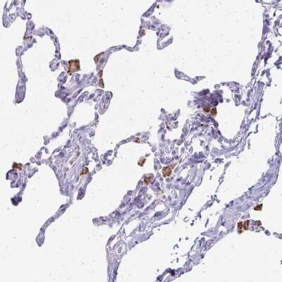 Immunohistochemistry-Paraffin: TRACP/PAP/ACP5 Antibody [NBP2-38833]