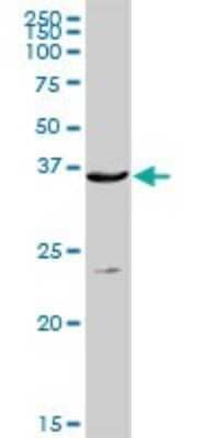 Western Blot: TRACP/PAP/ACP5 Antibody [H00000054-D01P]