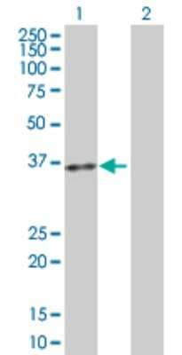 Western Blot: TRACP/PAP/ACP5 Antibody [H00000054-D01P]
