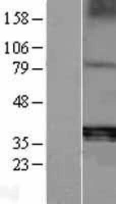 Western Blot: TRACP/PAP/ACP5 Overexpression Lysate [NBP2-09377]