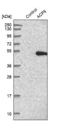 Western Blot: ACP6 Antibody [NBP1-89272]