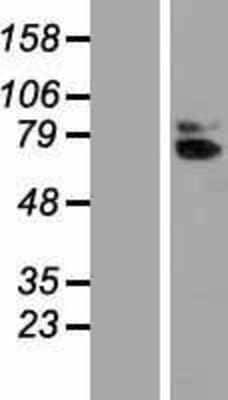 Western Blot: IL-18 R beta/IL-1 R7/ACPL Overexpression Lysate [NBP2-10544]