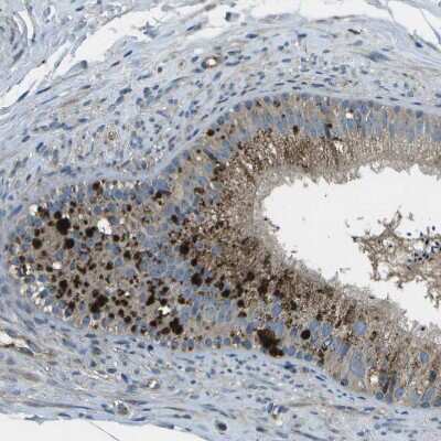 Immunohistochemistry-Paraffin: ACPL2 Antibody [NBP1-83577]