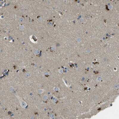 Immunohistochemistry-Paraffin: ACPL2 Antibody [NBP1-83577]