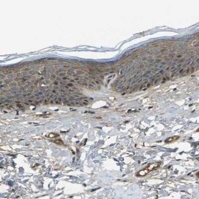Immunohistochemistry-Paraffin: ACPL2 Antibody [NBP1-83577]