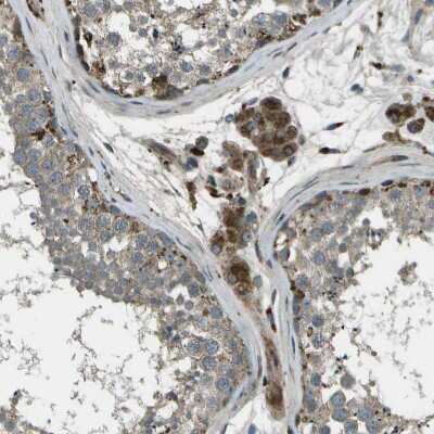 Immunohistochemistry-Paraffin: ACPL2 Antibody [NBP1-83577]